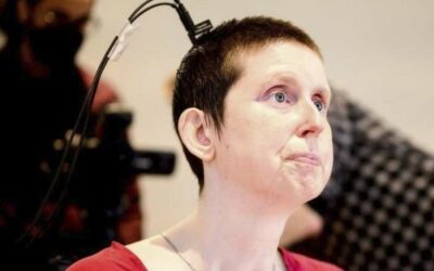 After Eighteen Years, A Stroke Survivor Was Able To Talk Because To This Brain-Computer Interface