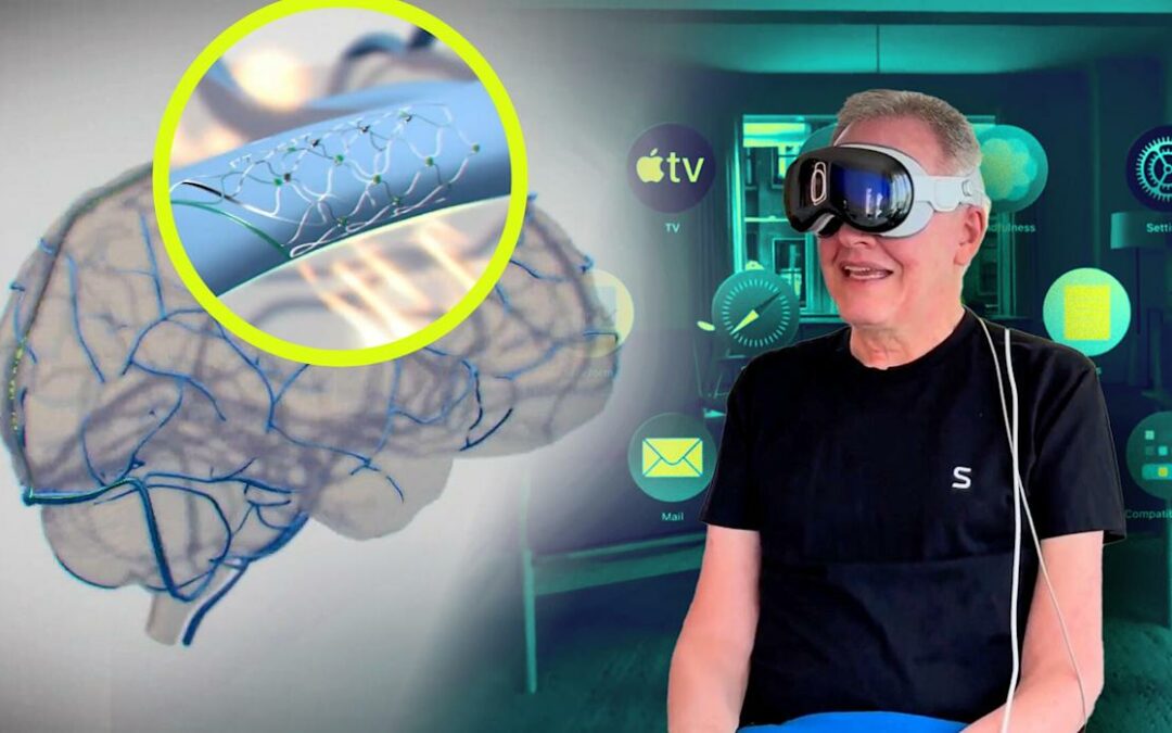 New Accessibility Features, Such As Future Support For Neural Implants, Are Announced By Apple